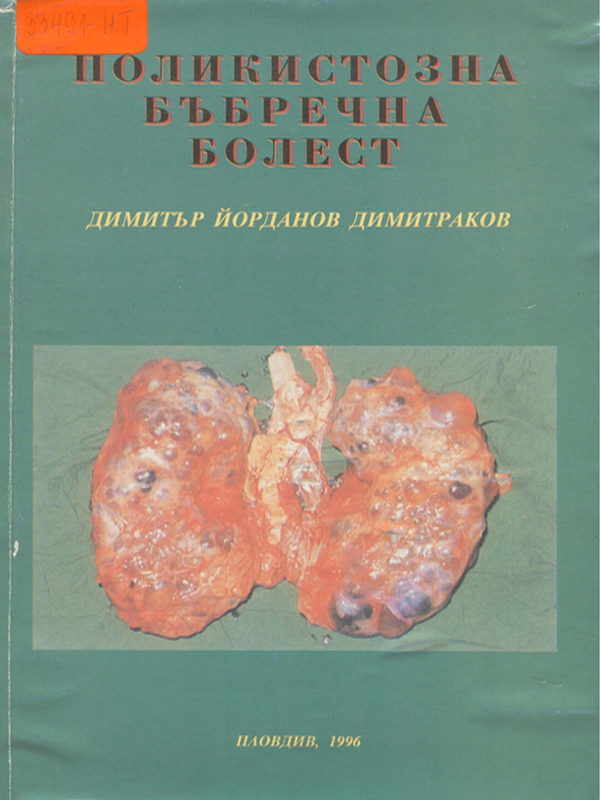 Поликистозна бъбречна болест