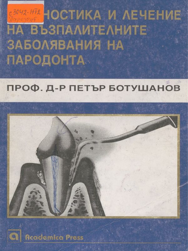 Диагностика и лечение на възпалителните заболявания на пародонта