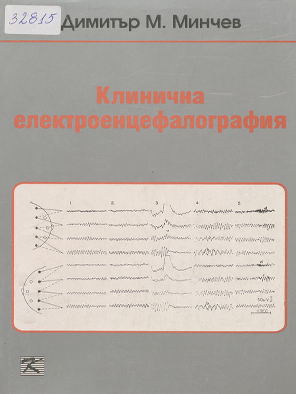 Клинична електроенцефалография