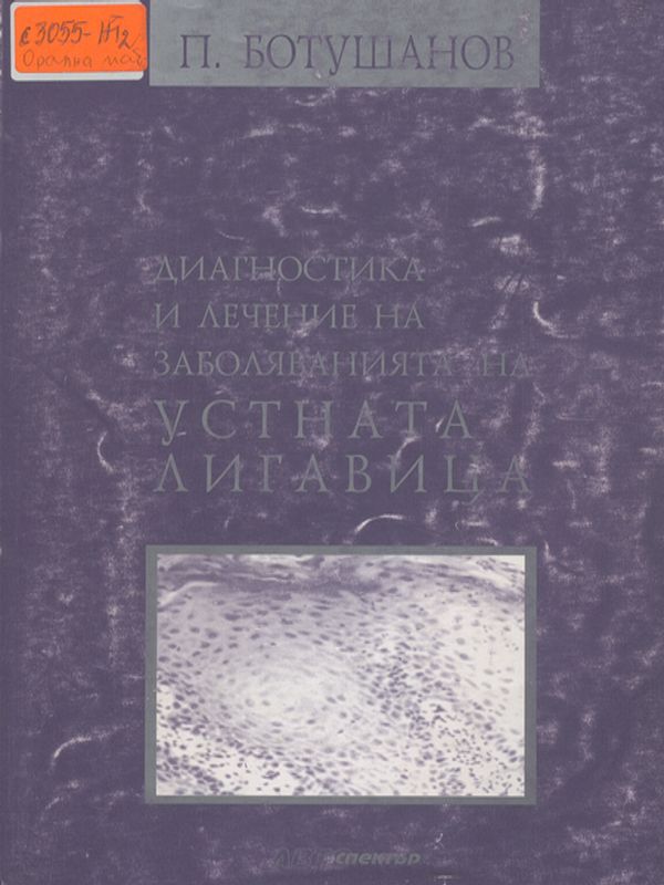Диагностика и лечение на заболяванията на устната лигавица