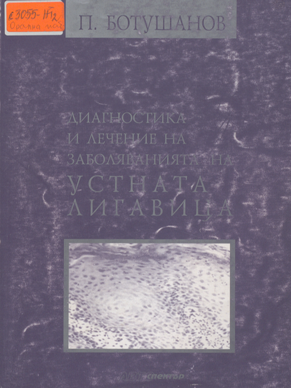 Диагностика и лечение на заболяванията на устната лигавица