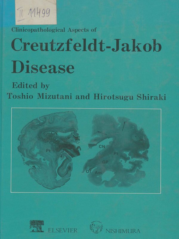 Clinicopathological Aspects of Creutzfeldt-Jakob Disease