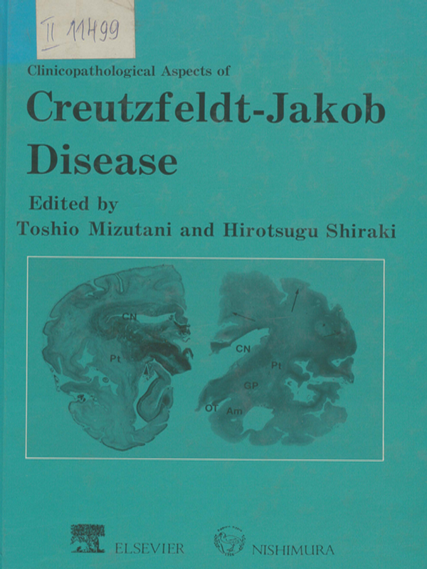 Clinicopathological Aspects of Creutzfeldt-Jakob Disease