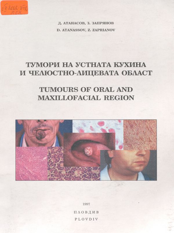 Тумори на устната кухина и челюстно-лицевата област