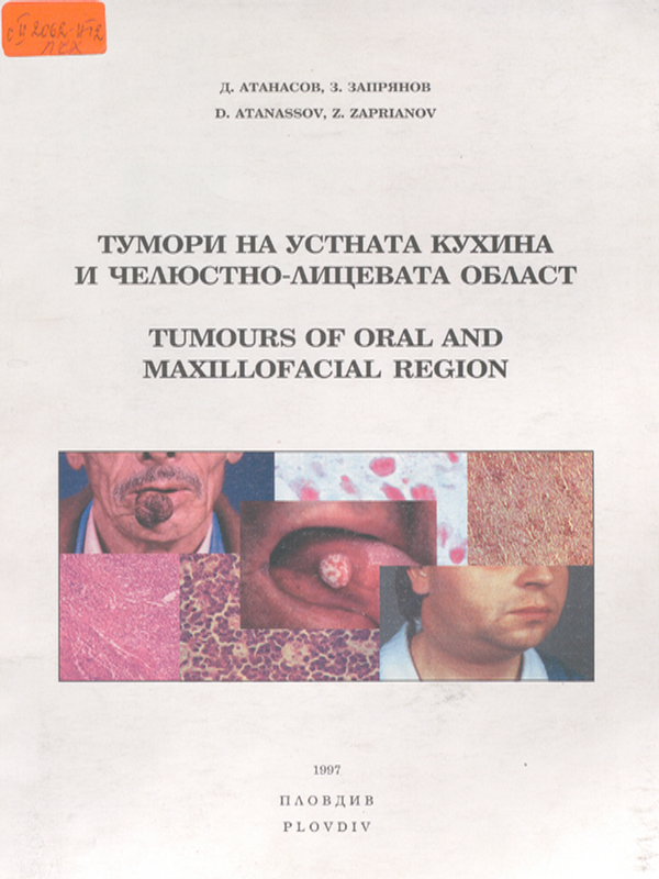 Тумори на устната кухина и челюстно-лицевата област
