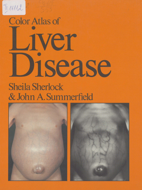 Color Atlas of Liver Disease