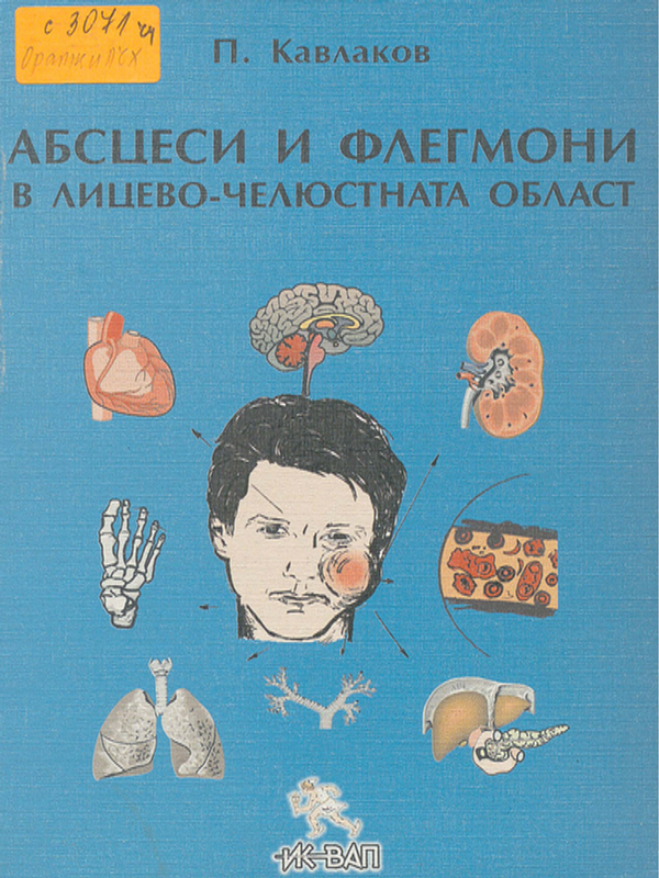 Абсцеси и флегмони в лицево-челюстната област