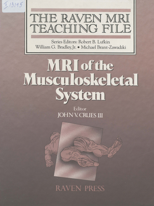 MRI of the musculoskeletal system