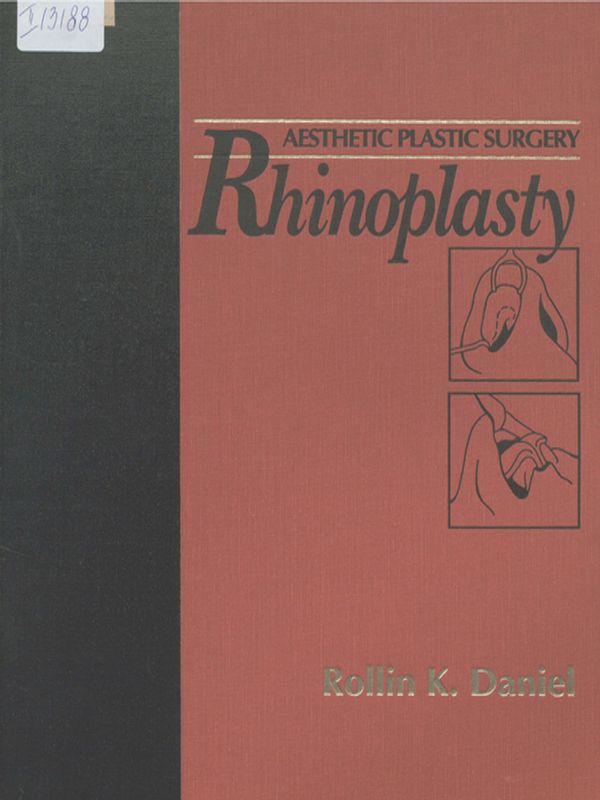 Rhinoplasty