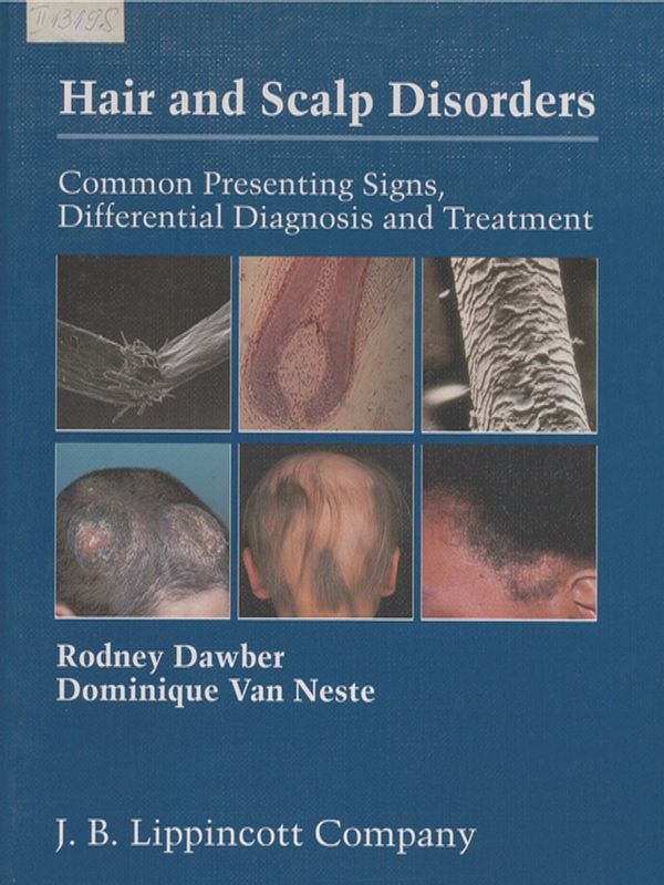 Hair and Scalp Disorders