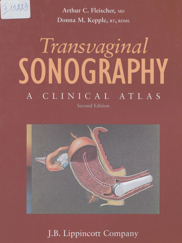 Transvaginal sonography
