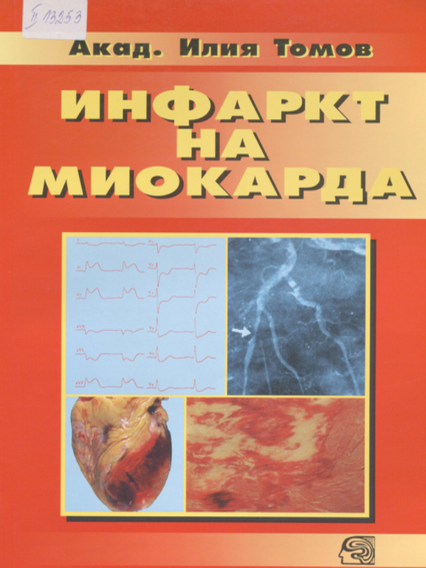 Инфаркт на миокарда