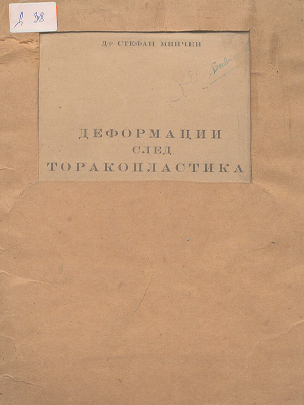 Деформации след торакопластики