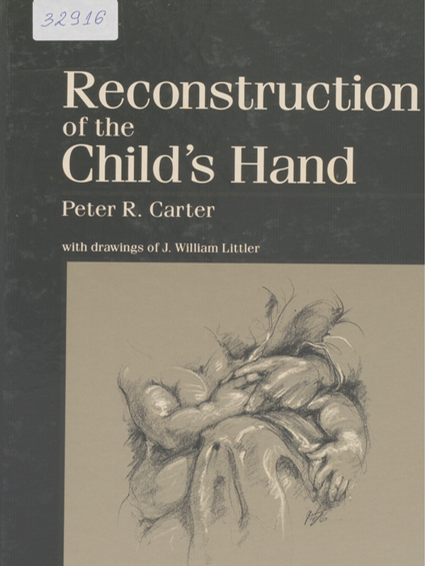 Reconstruction of the Child's Hand