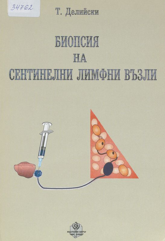 Биопсия на сентинелни лимфни възли