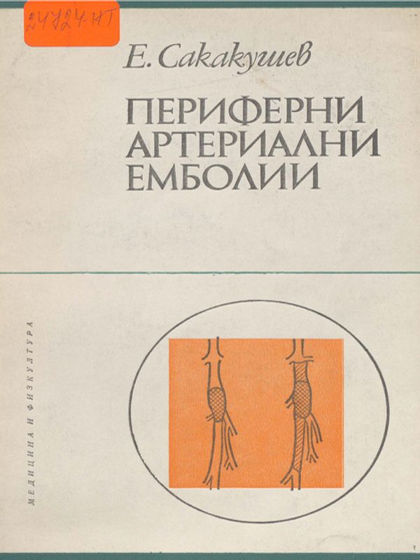 Периферни артериални емболии