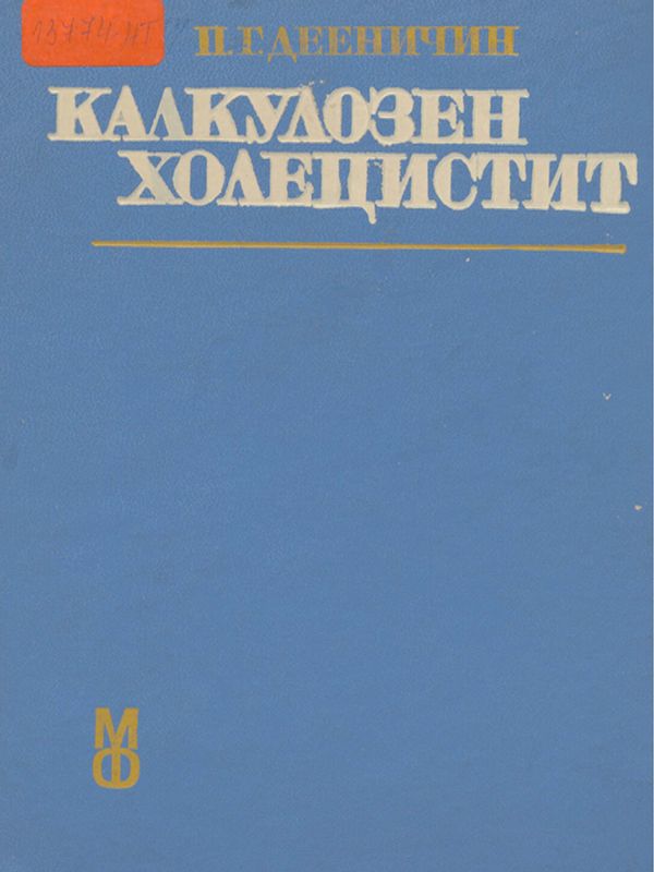 Калкулозен холецистит