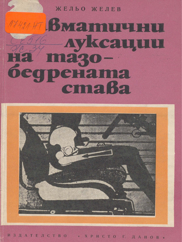 Травматични луксации на тазобедрената става