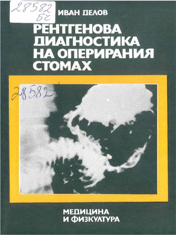 Рентгенова диагностика на оперирания стомах