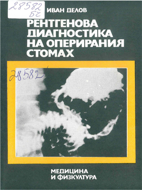 Рентгенова диагностика на оперирания стомах