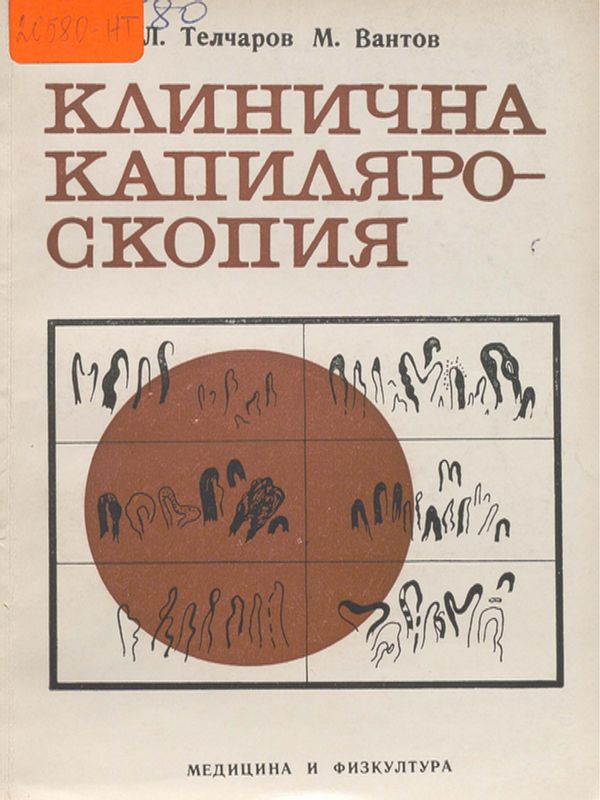 Клинична капиляроскопия