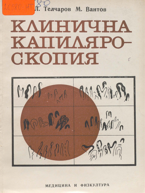 Клинична капиляроскопия