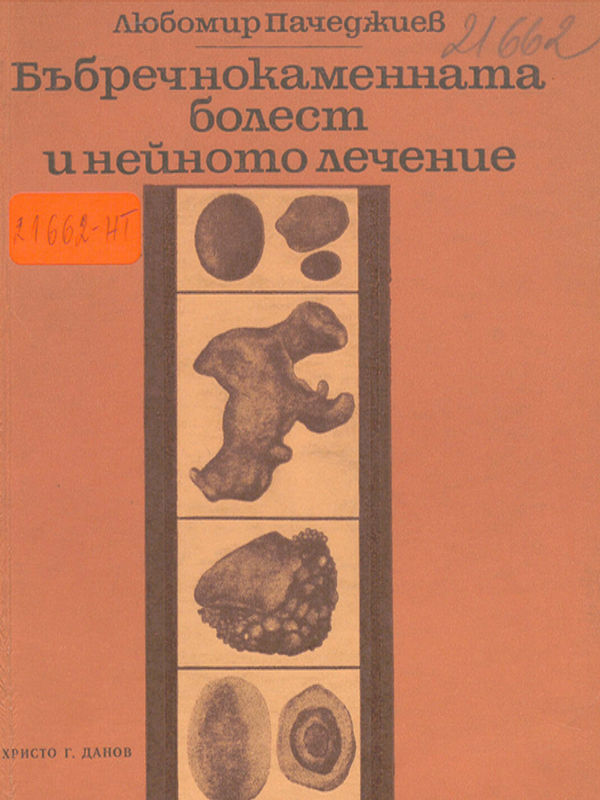 Бъбречнокаменната болест и нейното лечение