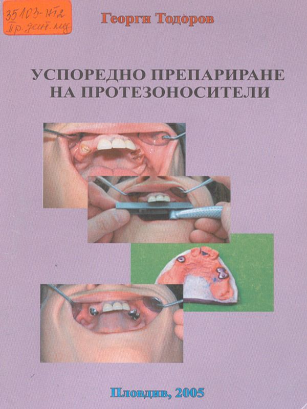 Успоредно препариране на протезоносители