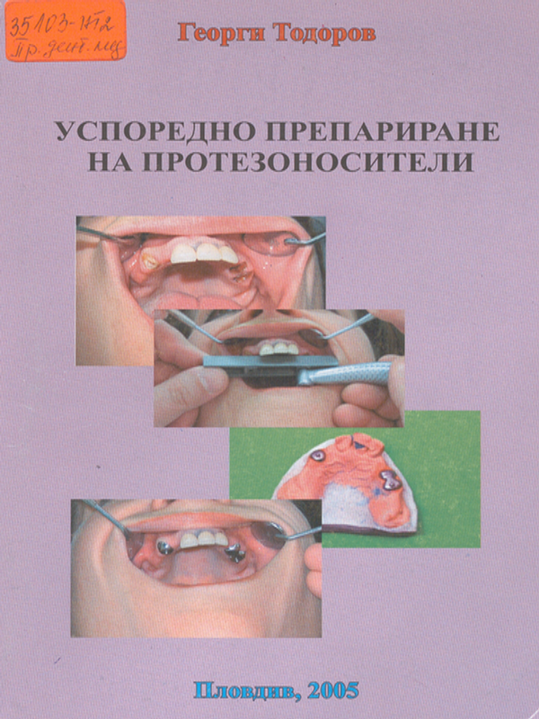 Успоредно препариране на протезоносители