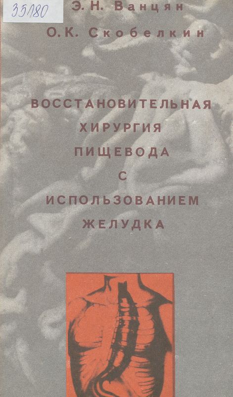 Восстановительная хирургия пищевода с использованием желудка