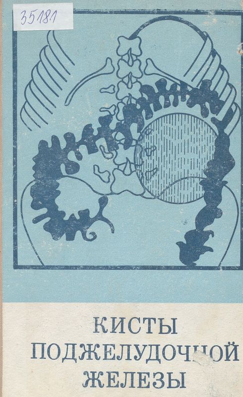 Кисты поджелудочной железы