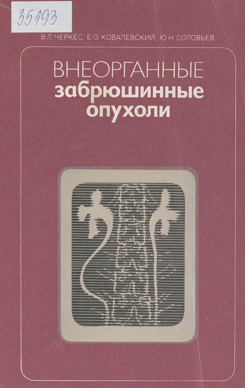 Внеорганные забрюшинные опухоли