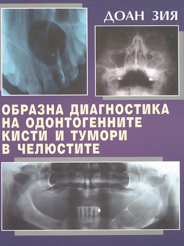 Образна диагностика на одонтогенните кисти и тумори в челюстите