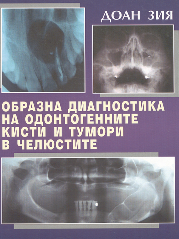 Образна диагностика на одонтогенните кисти и тумори в челюстите