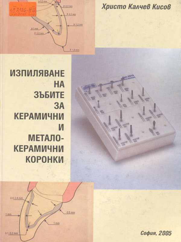 Изпиляване на зъбите за керамични и металокерамични коронки