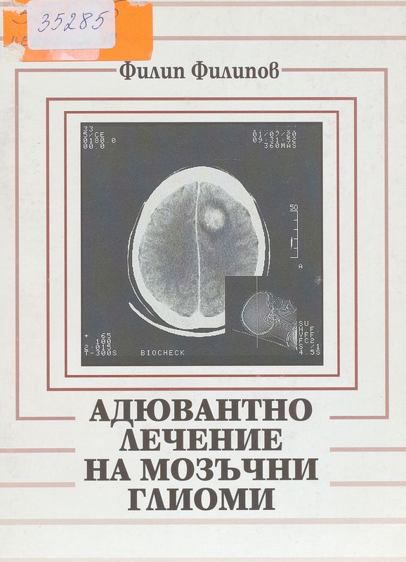 Адювантно лечение на мозъчни глиоми