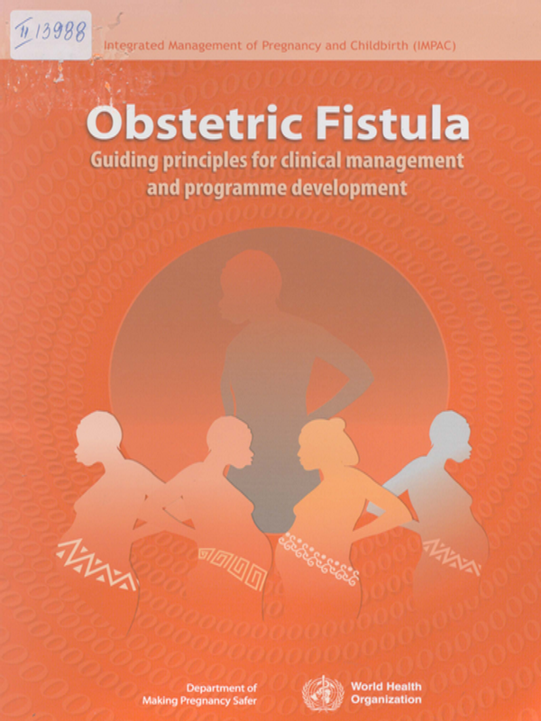 Obstetric fistula