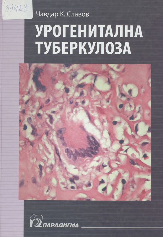 Урогенитална туберкулоза