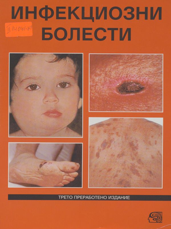 Инфекциозни болести