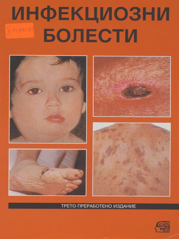 Инфекциозни болести