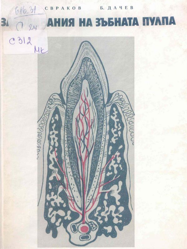 Заболявания на зъбната пулпа