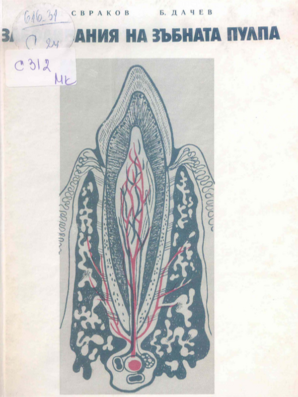 Заболявания на зъбната пулпа