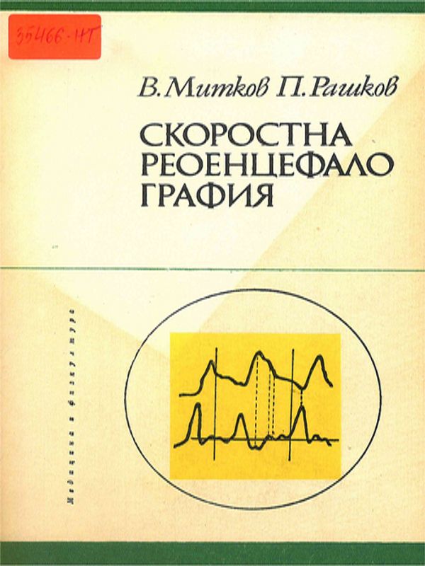 Скоростна реоенцефалография