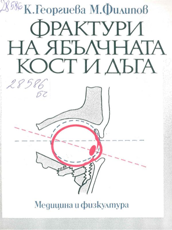 Фрактури на ябълчната кост и дъга