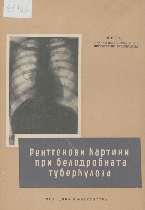 Рентгенови картини при белодробната туберкулоза