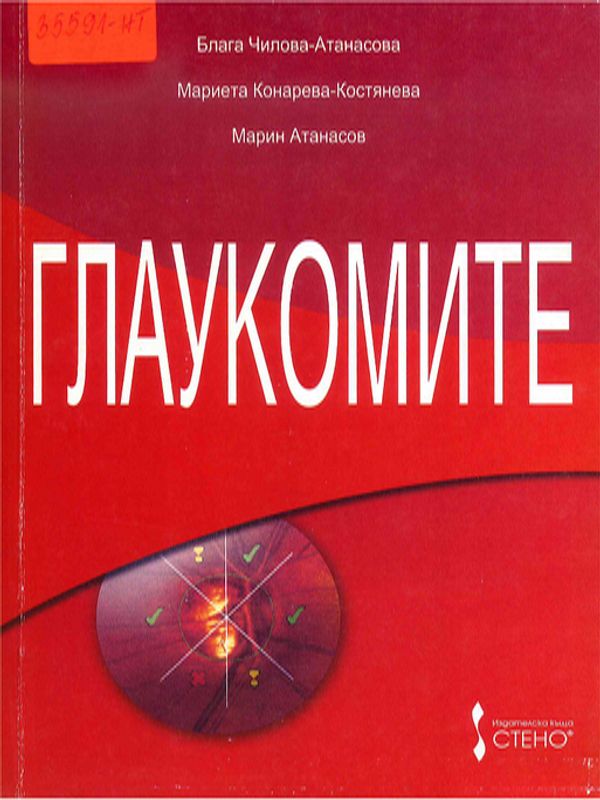 Глаукомите