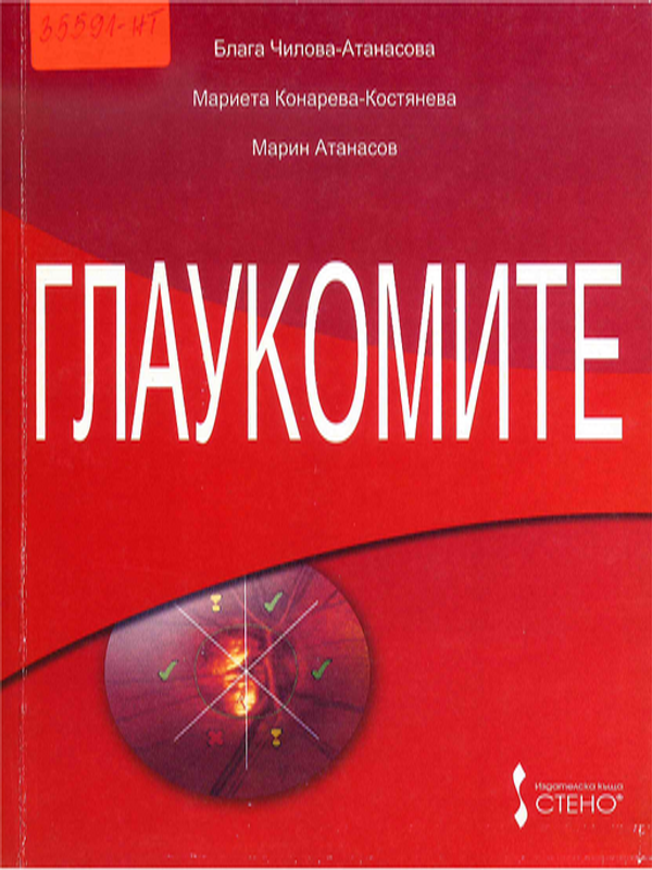 Глаукомите