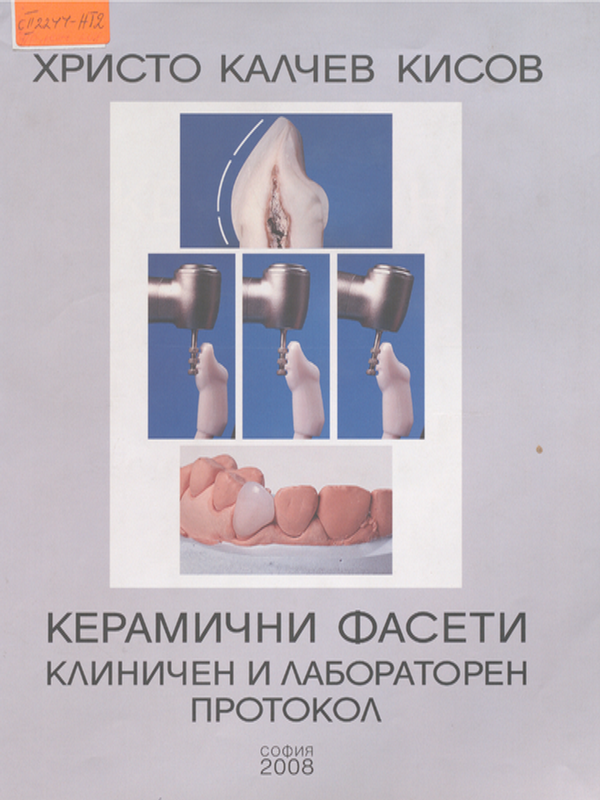 Керамични фасети