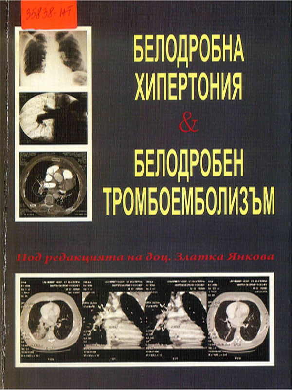 Белодробна хипертония. Белодробен тромбоемболизъм