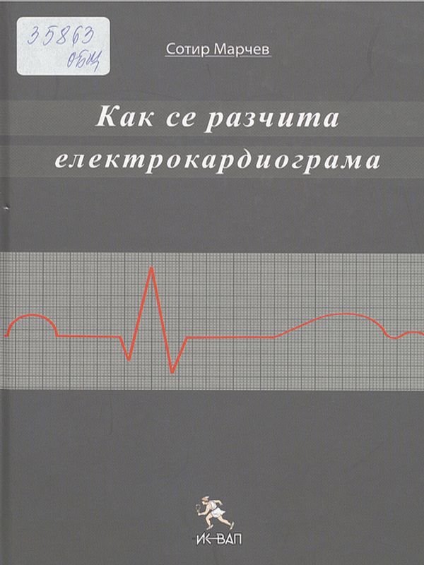 Как се разчита електрокардиограма